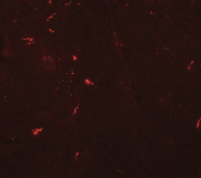 Immunocytochemistry/Immunofluorescence: Draxin/C1orf187 Antibody [NBP2-41135] - Immunofluorescence of NEUCRIN in mouse brain tissue with NEUCRIN antibody at 20 ug/mL.
