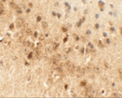 Immunohistochemistry: Draxin/C1orf187 Antibody [NBP2-41135] - Immunohistochemistry of NEUCRIN in mouse brain tissue with NEUCRIN antibody at 5 ug/mL.