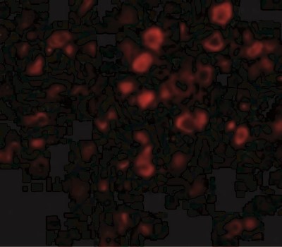 Immunocytochemistry/Immunofluorescence: Bora Antibody [NBP1-77346] - Immunofluorescence of Bora in Mouse Brain cells with Bora antibody at 20 ug/mL.