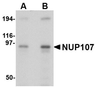 Western Blot: Nucleoporin 107 Antibody [NBP1-76926] - A549 cell lysate with NUP107 antibody at (A) 1 and (B) 2 ug/mL.