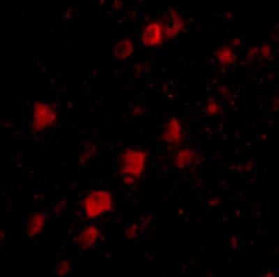Immunocytochemistry/Immunofluorescence: POLR3F Antibody [NBP1-76929] - Immunofluorescence of POLR3F in human brain tissue with POLR3F antibody at 20 ug/mL.