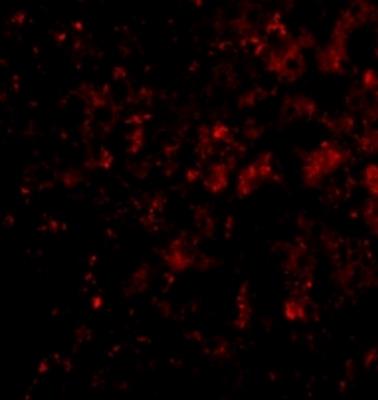 Immunocytochemistry/Immunofluorescence: DRAM Antibody [NBP1-76759] - Liver cells.