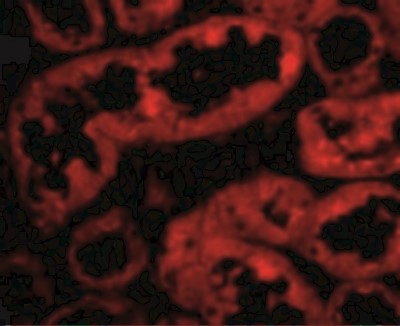 Immunocytochemistry/Immunofluorescence: ACE-2 Antibody [NBP1-76611] - Immunofluorescence of ACE2 in Human Kidney cells with ACE2 antibody at 10 ug/mL.