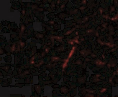 Immunocytochemistry/Immunofluorescence: KA1/GRIK4/Glutamate Receptor KA1 Antibody [NBP1-76852] - Immunofluorescence of Grik4 in Human Brain cells with Grik4 antibody at 20 ug/mL.