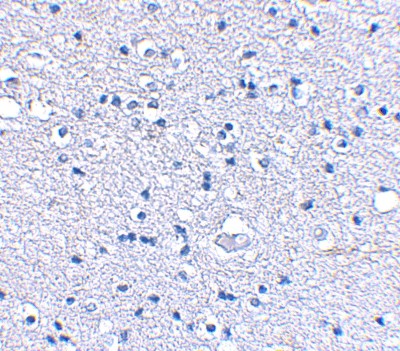 Immunohistochemistry-Paraffin: KA1/GRIK4/Glutamate Receptor KA1 Antibody [NBP1-76852] - Human brain tissue using Glutamate receptor KA1 antibody at 2.5 ug/ml.