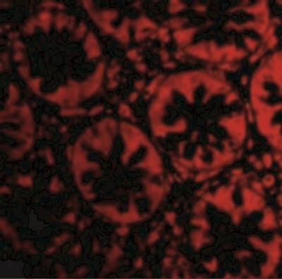 Immunofluorescence: RASD2 Antibody [NBP1-77313] - Immunofluorescence of TEM2 in Human Colon cells with TEM2 antibody at 20 ug/mL.