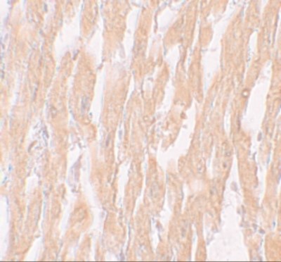 Immunohistochemistry: Importin alpha 2/KPNA2 Antibody [NBP1-76298] - Immunohistochemistry of KPNA2 in human heart tissue with KPNA2 antibody at 5 ug/mL.