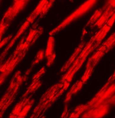 Immunofluorescence: Importin alpha 2/KPNA2 Antibody [NBP1-76298] - Immunofluorescence of KPNA2 in human heart tissue with KPNA2 antibody at 20 ug/mL.