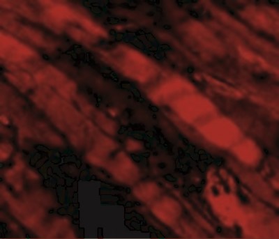 Immunocytochemistry/Immunofluorescence: Emerin Antibody [NBP1-76757] - Immunofluorescence of Emerin in Human Skeletal Muscle cells with Emerin antibody at 5 ug/mL.