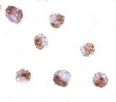 Immunocytochemistry/Immunofluorescence: PAK6 Antibody [NBP1-76632] - Raji cells with PAK6 antibody at 10 ug/ml.