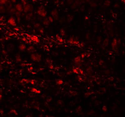Immunocytochemistry/Immunofluorescence: ESRP1 Antibody [NBP1-76536] - Immunofluorescence of ESRP1 in human colon tissue cells with ESRP1 antibody at 20 ug/mL.
