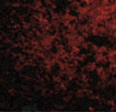 Immunofluorescence: SP110 Antibody [NBP1-77316] - SP110 in Human Brain cells with IPR1 antibody at 50 ug/mL.