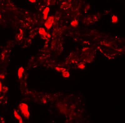 Immunocytochemistry/Immunofluorescence: EZH1 Antibody [NBP1-76561] - Immunofluorescence of EZH1 in human lung tissue with EZH1 antibody at 20 ug/mL.