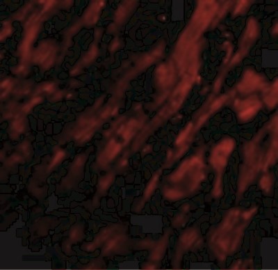 Immunocytochemistry/Immunofluorescence: UNG Antibody [NBP1-76713] - Immunofluorescence of UNG1 in Human Heart cells with UNG1 antibody at 20 ug/mL.