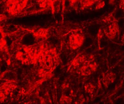 Immunocytochemistry/Immunofluorescence: ROCK2 Antibody [NBP1-76570] - Immunofluorescence of ROCK2 in mouse brain tissue with ROCK2 antibody at 20 ug/mL.