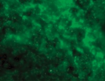 Immunofluorescence: DC-SIGN/CD209 Antibody [NBP1-77284] - Immunofluorescence of DC-SIGN in Human Lymph Node tissue with DC-SIGN antibody at 20 ug/mL.