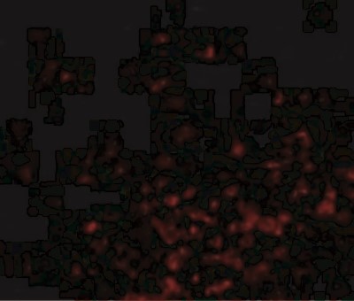 Immunocytochemistry/Immunofluorescence: Bag-1 Antibody [NBP1-76714] - Immunofluorescence of BAG-1 in Human Lymph Node cells with BAG-1 antibody at 20 ug/mL.