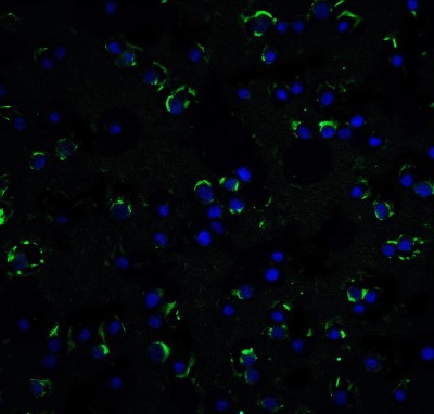 Immunocytochemistry/Immunofluorescence: RAIDD/CRADD Antibody [NBP1-77061] - Staining of RAIDD in HeLa cells with RAIDD antibody at 5 ug/ml.