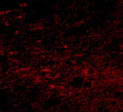 Immunocytochemistry/Immunofluorescence: Polypeptide GalNac Transferase 10/GALNT10 Antibody [NBP1-77059] - Immunofluorescence of GALNT10 in human brain tissue with GALNT10 antibody at 20 ug/mL.