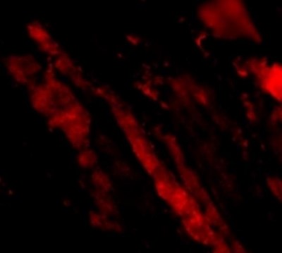 Immunocytochemistry/Immunofluorescence: Sin1/MAPKAP1 Antibody [NBP1-76776] - Human Skeletal Muscle cells.