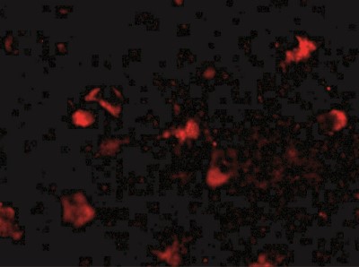 Immunocytochemistry/Immunofluorescence: MEX3A Antibody [NBP2-41092] - Immunofluorescence of rkhd4 in human brain tissue with rkhd4 antibody at 20 ug/mL.