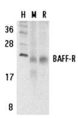 Western Blot: BAFF Receptor Antibody [NBP1-77234] - Human (H), mouse (M), and rat (R) spleen tissue lysates with BAFF Receptor antibody at 5 ug/ml.