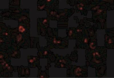Immunocytochemistry/Immunofluorescence: CX3CR1 Antibody [NBP1-76872] - THP-1 cells with CX3CR1 antibody at 20 ug/mL.