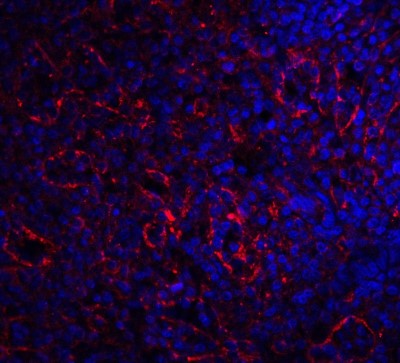 Immunocytochemistry/Immunofluorescence: BAFF Receptor Antibody [NBP1-77234] - Staining of BAFF-R in human spleen tissue with BAFF-R antibody at 20 ug/ml.