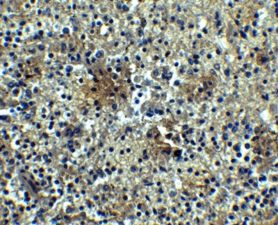 Immunohistochemistry: BAFF Receptor Antibody [NBP1-77234] - Staining of human spleen tissue with antibody at 5 ug/mL.