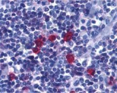 Immunohistochemistry-Paraffin: BAFF Receptor Antibody [NBP1-77234] - Human tonsil tissue with BAFF Receptor antibody at 5 ug/ml.