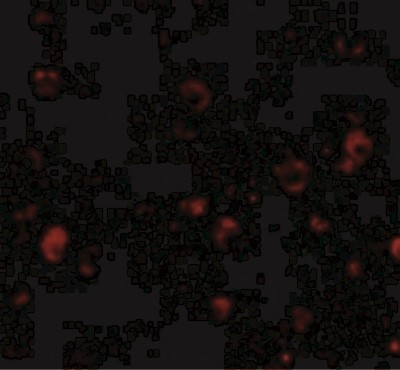 Immunofluorescence: BRSK1 Antibody [NBP1-77280] - Immunofluorescence of BRSK1 in Human Brain cells with BRSK1 antibody at 20 ug/mL.