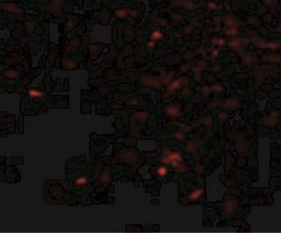 Immunofluorescence: NIPSNAP1 Antibody [NBP1-76887] - Human Brain cells with NIPSNAP antibody at 20 ug/mL.
