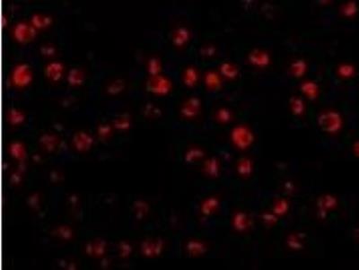 Immunocytochemistry/Immunofluorescence: OTUD4 Antibody [NBP1-77003] - in Daudi cells with OTUD4 antibody at 20 ug/mL.