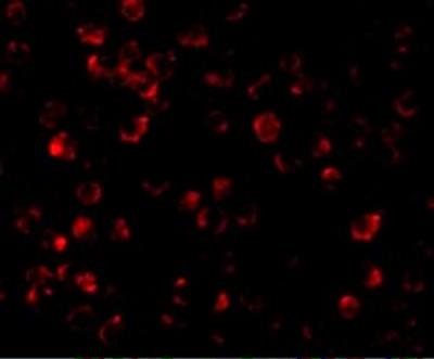Immunocytochemistry/Immunofluorescence: IRAK4 Antibody [NBP1-77231] - ICC-IF staining of IRAK4 protein on K562 cells using IRAK4 antibody at 10 ug/mL concentration.