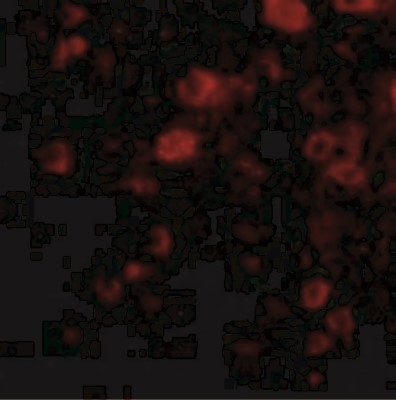 Immunocytochemistry/Immunofluorescence: VGF Antibody [NBP1-76906] - Immunofluorescence of VGF in Human Brain cells with VGF antibody at 20 ug/mL.