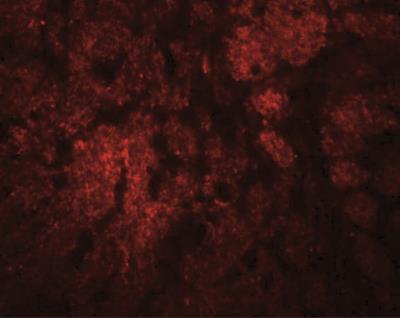 Immunocytochemistry/Immunofluorescence: CCDC106 Antibody [NBP1-77381] - Immunofluorescence of CCDC106 in rat brain tissue with CCDC106 antibody at 20 ug/mL.