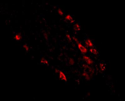 Immunocytochemistry/Immunofluorescence: MEX3D Antibody [NBP1-77332] - Immunofluorescence of rkhd1 in human small intestine tissue with rkhd1 antibody at 20 ug/mL.