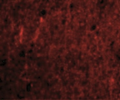 Immunocytochemistry/Immunofluorescence: CDNF Antibody [NBP1-76835] - Immunofluorescence of CDNF in Human Brain cells with CDNF antibody at 20 ug/mL.