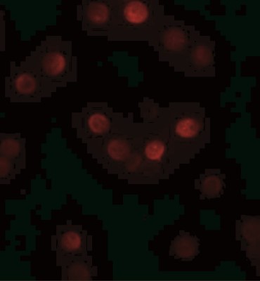 Immunofluorescence: SIP1 Antibody [NBP1-77177] - HeLa cells at 20 ug/mL.