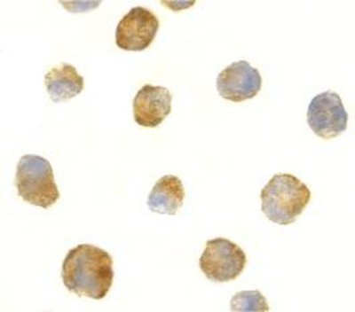 Immunocytochemistry/Immunofluorescence: ATR Antibody [NBP1-77232] - K562 cells with ATR antibody at 2 ug/ml.