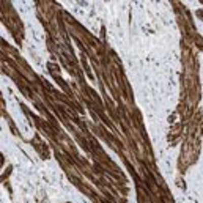 Immunohistochemistry: BTN3A2 Antibody [28010002] - Most of the normal tissues displayed moderate cytoplasmic positivity with an additional membranous staining in gastro-intestinal tract. Smooth muscle cells and lymphoid cells outside reaction centra showed strong cytoplasmic staining while strong nuclear staining was seen in a fraction of cells in seminiferous duct. Liver, renal tubules, prostate glands and neuronal tissues were weakly stained or negative. Malignant tissues exhibited similar staining properties as normal cells, mainly moderate cytoplasmic and/or membranous immunoreactivity. Many gliomas, prostate, skin, testicular, urothelial and renal cancers were weakly stained or negative.   Image and statement courtesy of the Human Protein Atlas (HPA).