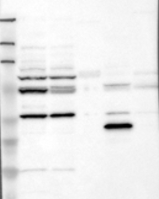 Western Blot: Opsin 3 Antibody [20770002] - Samples:  Lane 1, Marker [kDa]: 213, 118, 83, 50, 33, 26, 18  Lane 2, RT-4 Lane 3, U-251MG sp  Lane 4, Human Plasma  Lane 5, Liver  Lane 6, Tonsil,  Target weight [kDa]:   45, 36 (splice variants)   Validation score: 2 Validation description:   Supportive - Band of predicted size in kDa (+/-20%) with additional bands present.