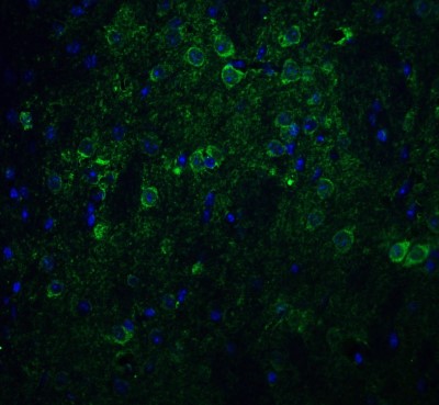 Immunocytochemistry/Immunofluorescence: Nicastrin Antibody [NBP1-77270] - Staining of Nicastrin in mouse brain tissue with Nicastrin antibody at 20 ug/ml.