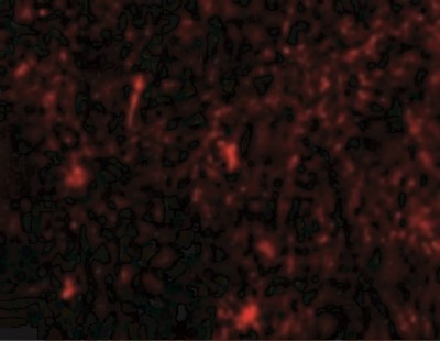 Immunofluorescence: Nicastrin Antibody [NBP1-77270] - Immunofluorescence of Nicastrin in Human Brain cells with Nicastrin antibody at 20 ug/mL.