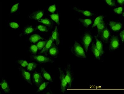 Immunocytochemistry/Immunofluorescence: Symplekin Antibody (4C2) [H00008189-M03] - Analysis of monoclonal antibody to SYMPK on HeLa cell. Antibody concentration 10 ug/ml