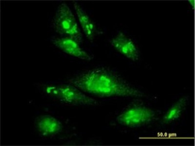 Immunocytochemistry/Immunofluorescence: Tbp7 Antibody (3G8) [H00005704-M01] - Analysis of monoclonal antibody to PSMC4 on HepG2 cell. Antibody concentration 10 ug/ml.