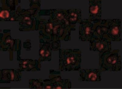Immunocytochemistry/Immunofluorescence: NAIP Antibody [NBP1-77196] - Immunofluorescence of NAIP in A549 cells with NAIP antibody at 20 ug/mL.