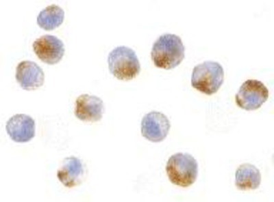 Immunocytochemistry/Immunofluorescence: NAIP Antibody [NBP1-77196] - A549 cells with NAIP antibody at 10 ug/ml.