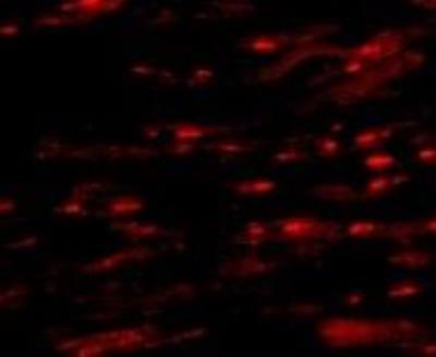 Immunocytochemistry/Immunofluorescence: ASAH1 Antibody [NBP1-76933] - Human Heart cells