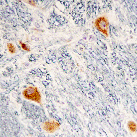 Cerebellin-2 was detected in immersion fixed paraffin-embedded sections of human brain (medulla) using Mouse Anti-Human Cerebellin-2 Monoclonal Antibody (Catalog # MAB70441) at 15 µg/mL overnight at 4 °C. Tissue was stained using the Anti-Mouse HRP-DAB Cell & Tissue Staining Kit (brown; Catalog # CTS002) and counterstained with hematoxylin (blue). Specific staining was localized to neuronal cell bodies. View our protocol for Chromogenic IHC Staining of Paraffin-embedded Tissue Sections.